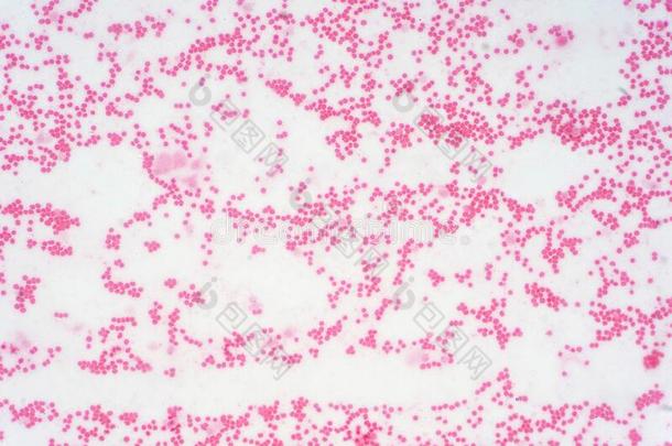 <strong>病理</strong>学习关于人茎细胞在下面显微镜