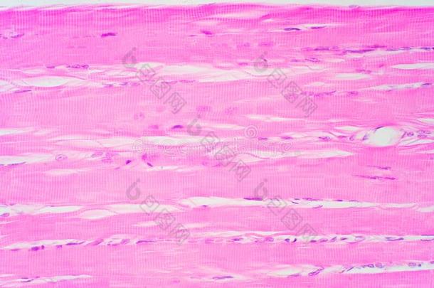 人骨骼的肌肉在下面显微镜看法为教育pathology病理学