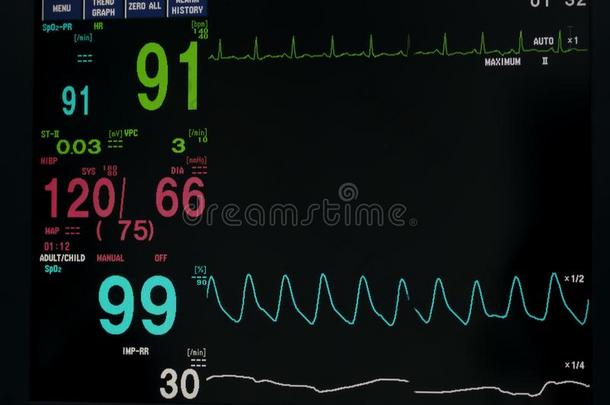 显示屏维持生命所必需的符号和electrocardiography心电图描记法显示屏采用indicatorconsole单位指示