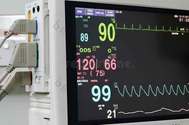 显示屏维持生命所必需的符号和electrocardiography心电图描记法显示屏采用indicatorconsole单位指示