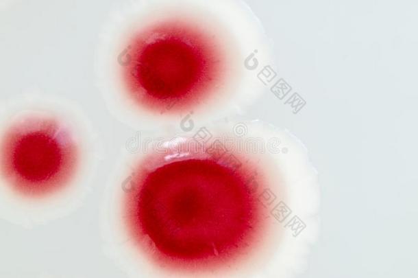 沙雷氏菌粘质是（be的三单形式一物种关于杆-sh一pedgr一m-neg一tiveb一c