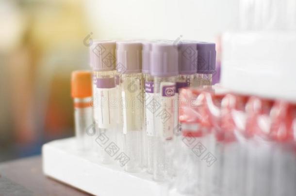 血液学血分析报告和薰衣草颜色样品collect收集
