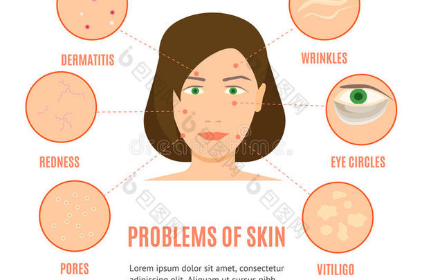 女孩护理皮肤的不同的问题卡片或海报Vect或