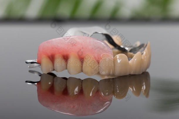骨骼的假体-艺术关于牙科