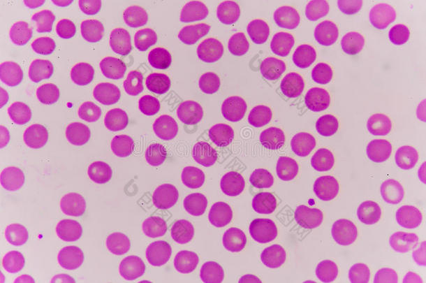 常色normacytic红色的血细胞