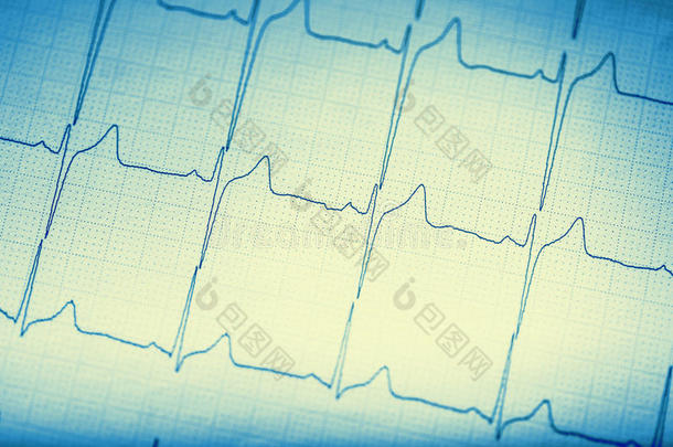 electrocardio图表y心电图描记法图表.心电图electrocardiography心电图描记法exportcredi