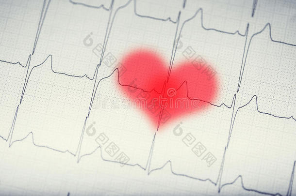 electrocardio图表y心电图描记法图表.心电图electrocardiography心电图描记法exportc红色的i