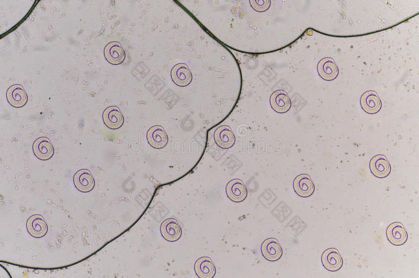 类圆线虫胸珊瑚