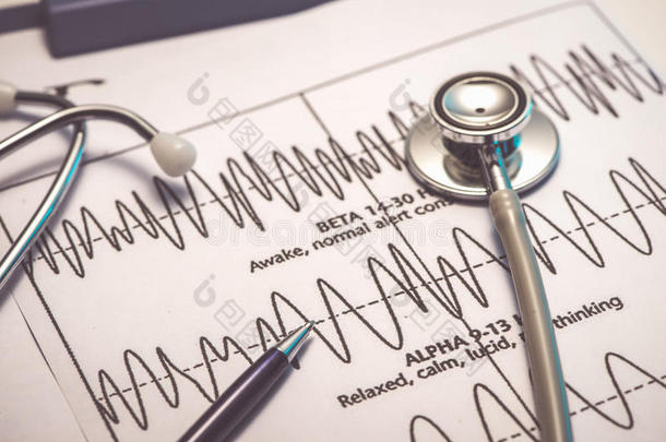 心电图脉搏跟踪和听诊器观念为心血管病