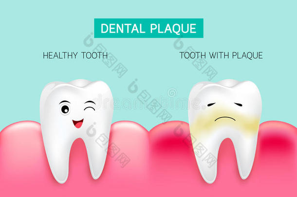 牙齿的匾额和炎症和健康的牙.