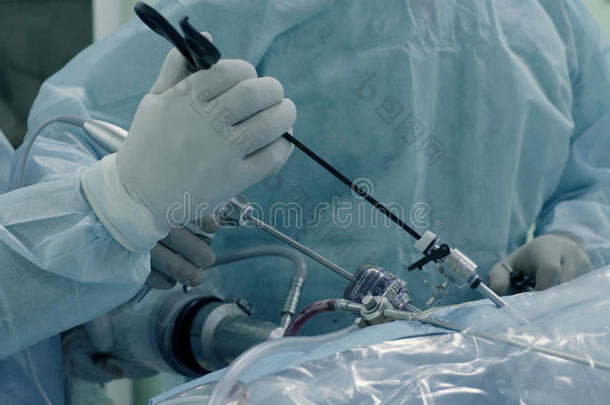 腹腔镜检查的外科学关于指已提到的人腹部