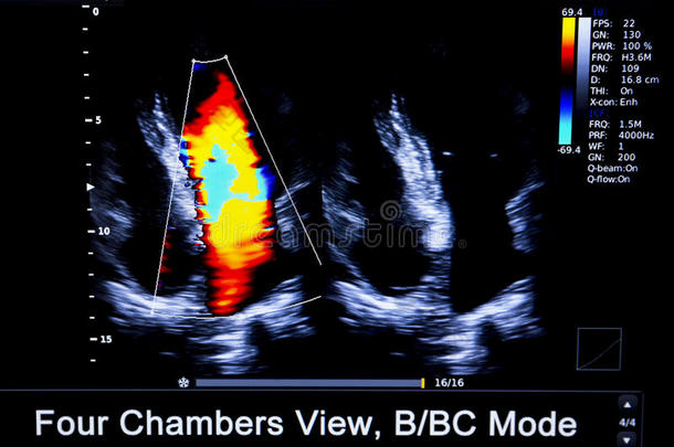 颜色鲜艳的影像关于霍曼心超声显示屏
