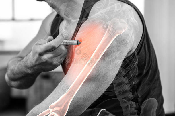 突出的臂关于强的男人注射<strong>合成代谢</strong>的甾类化合物在健身房
