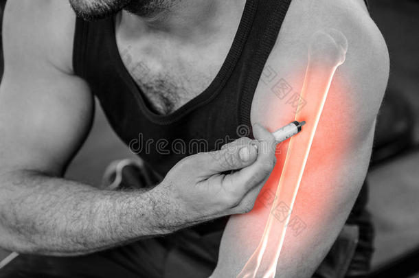 突出的臂关于强的男人注射<strong>合成代谢</strong>的甾类化合物在健身房