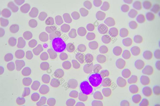 白色的血细胞