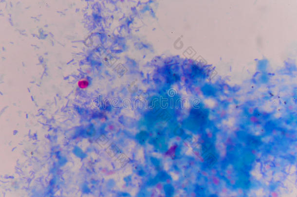 隐孢子虫卵母细胞向蓝色