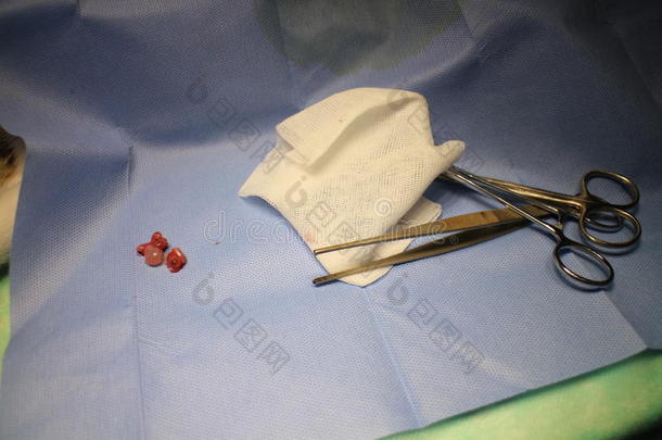 外科的介入-阉割卵巢和卵巢的囊肿