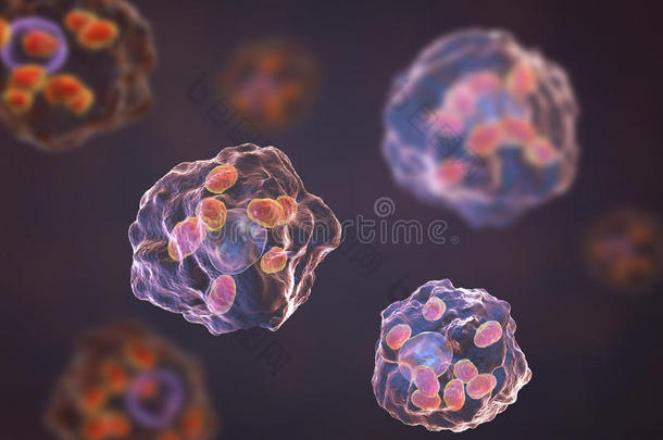巨噬细胞被感染的在旁边利什马尼亚无鞭毛体