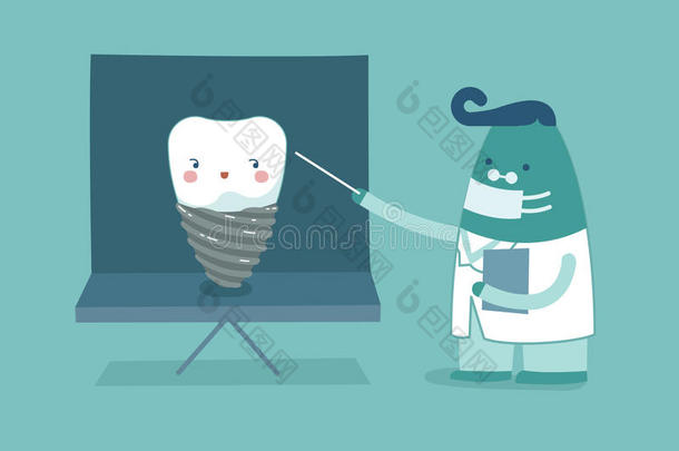 牙科医生是（be的三单形式<strong>讲解</strong>关于移植物,牙和牙观念关于