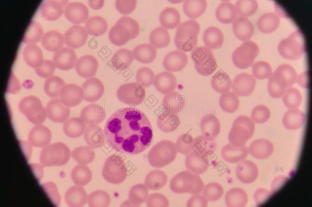 白色的血细胞向红色的血细胞背景.