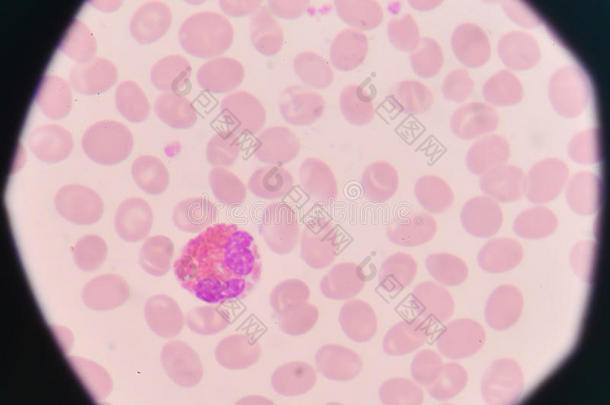 白色的血细胞向红色的血细胞背景.