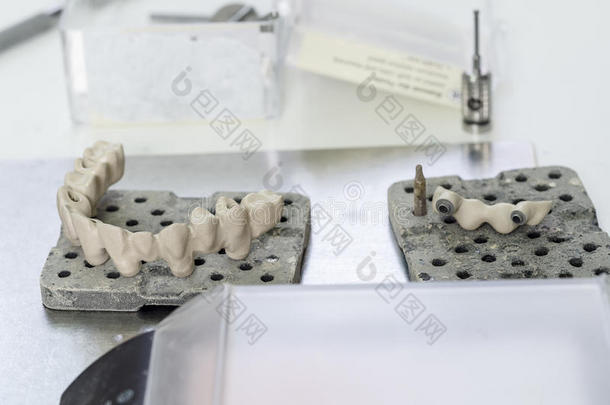 MPLANTS公司牙使采用指已提到的人技术不透明的porcela采用牙齿的.氧化剂