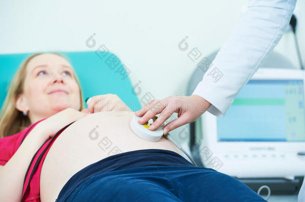 怀孕关心.心<strong>分娩</strong>力描记法：<strong>分娩</strong>过程中监测胎儿心率和子宫收缩的方法胎儿的心跳检查