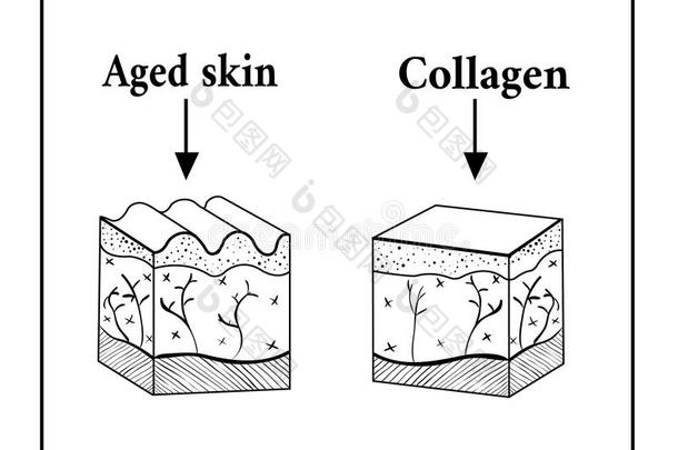 概要关于指已提到的人皮在下面指已提到的人影响关于胶原蛋白.