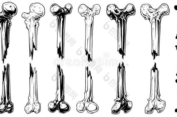 图解的黑的和白色的破碎的骨骼矢量放置
