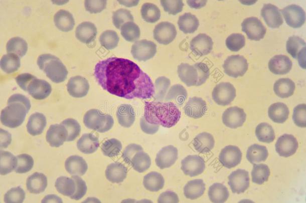 单核细胞和疟疾寄生物